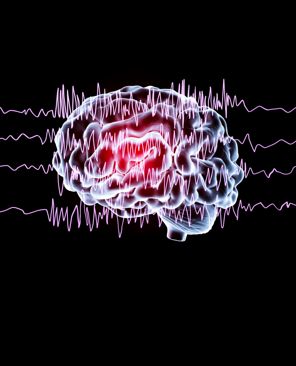 Un trattamento con ossigeno al 100% può migliorare l’apprendimento motorio in un cervello sano